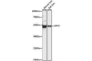 Western blot analysis of extracts of various cell lines using OPTC Polyclonal Antibody at dilution of 1:1000. (OPTC antibody)