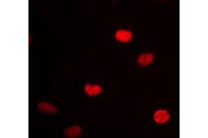 Immunofluorescent analysis of hnRNP D0 staining in HEK293 cells. (HNRNPD/AUF1 antibody  (Center))
