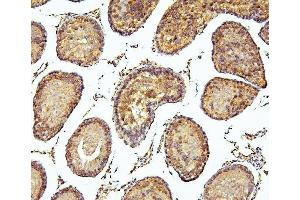 IHC analysis of PEF1 using anti-PEF1 antibody (ABIN6719632). (PEF1 antibody  (AA 170-284))