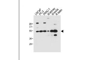 All lanes : Anti-DMRT3 Antibody (C-term) at 1:500 dilution Lane 1: LNCaP whole cell lysate Lane 2: PC-3 whole cell lysate Lane 3: NC-1 whole cell lysate Lane 4: Mouse kidney tissue lysate Lane 5: Mouse testis tissue lysate Lane 6: Rat testis tissue lysate Lysates/proteins at 20 μg per lane. (DMRT3 antibody  (C-Term))