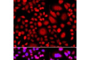 Immunofluorescence analysis of A549 cells using PRKAG3 Polyclonal Antibody (PRKAG3 antibody)