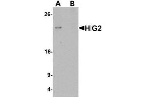 Western blot analysis of HIG2 in 3T3 cell lysate with HIG2 antibody at 1 ug/mL in (A) the absence and (B) the presence of blocking peptide.