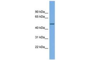 Image no. 1 for anti-Lipase I (LIPI) (AA 359-408) antibody (ABIN6743401) (Lipase I antibody  (AA 359-408))