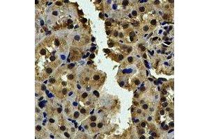 Immunohistochemical analysis of CALCOCO1 staining in human kidney formalin fixed paraffin embedded tissue section.