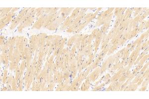 Detection of MYL3 in Human Cardiac Muscle Tissue using Polyclonal Antibody to Myosin Light Chain 3, Alkali, Ventricular, Slow Skeletal (MYL3) (MYL3/CMLC1 antibody  (AA 5-181))
