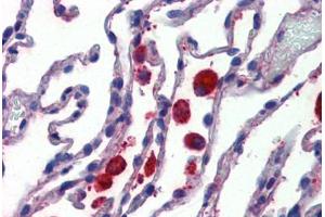 Anti-C14orf1 antibody  ABIN1048360 IHC staining of human lung. (C14orf1 antibody  (Internal Region))
