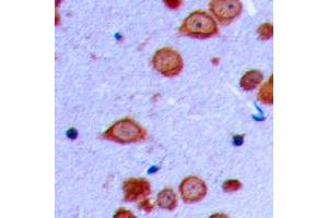 Immunohistochemical analysis of PRKD2 (pS876) staining in human brain formalin fixed paraffin embedded tissue section. (PKD2 antibody  (C-Term, pSer876))