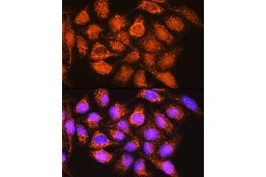 Immunofluorescence analysis of HeLa cells using B1 Rabbit pAb (ABIN1678629, ABIN3018003, ABIN3018005 and ABIN6220332) at dilution of 1:100. (ALDH1B1 antibody  (AA 278-517))