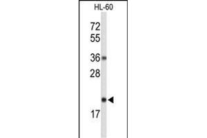 RNASEH2C anticorps  (AA 80-108)