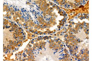 ABIN6261582 and ABIN6276939 at 1/100 staining Mouse testis tissue by IHC-P. (EPXH2 (C-Term) antibody)