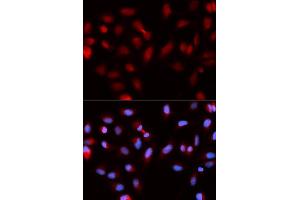 Immunofluorescence analysis of U2OS cells using BIRC5 antibody (ABIN5970737). (Survivin antibody)