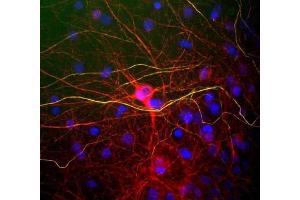 View of mixed neuron/glial cultures stained with ABIN1842224 (red) and rabbit antibody to phosphorylated NF-H (RPCA- NF-H, green). (NEFL antibody)