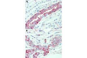 Immunohistochemical staining of human kidney (A) and human breast (B) with SLC4A2 polyclonal antibody . (SLC4A2 antibody  (N-Term))