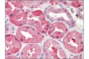 Immunohistochemistry (IHC) image for anti-Fatty Acid Binding Protein 1, Liver (FABP1) (AA 1-127), (N-Term) antibody (ABIN317518)