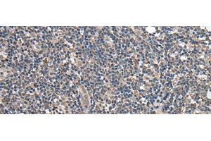 Immunohistochemistry of paraffin-embedded Human tonsil tissue using BRI3BP Polyclonal Antibody at dilution of 1:35(x200) (BRI3BP antibody)