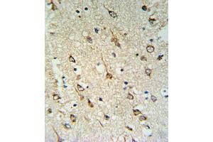 DNAJC6 Antibody (Center) (ABIN653940 and ABIN2843170) IHC analysis in formalin fixed and paraffin embedded human brain tissue followed by peroxidase conjugation of the secondary antibody and DAB staining. (DNAJC6 antibody  (AA 254-281))