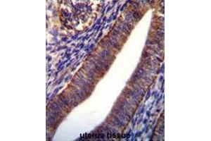 COL21A1 Antibody (N-term) immunohistochemistry analysis in formalin fixed and paraffin embedded human uterus tissue followed by peroxidase conjugation of the secondary antibody and DAB staining. (COL21A1 antibody  (Chain alpha 1, N-Term))