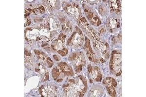 Immunohistochemical staining of human kidney with C10orf129 polyclonal antibody  shows moderate cytoplasmic positivity in renal tubules. (C10ORF129 antibody)