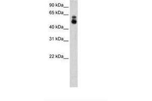 Image no. 2 for anti-Histone Deacetylase 9 (HDAC9) (C-Term) antibody (ABIN205000) (HDAC9 antibody  (C-Term))