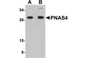 Western Blotting (WB) image for anti-PPPDE Peptidase Domain Containing 1 (PPPDE1) (C-Term) antibody (ABIN1030594) (PPPDE1 antibody  (C-Term))