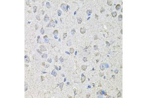 Immunohistochemistry of paraffin-embedded mouse brain using CD97 antibody at dilution of 1:100 (x40 lens). (CD97 antibody)