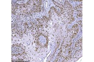IHC analysis of JHDM3A/JMJD2A/KDM4A using anti-JHDM3A/JMJD2A/KDM4A antibody (ABIN7601534). (KDM4A antibody  (AA 379-1064))