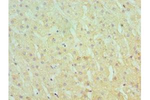 Immunohistochemistry of paraffin-embedded human liver tissue using ABIN7166367 at dilution of 1:100 (SERPINA1 antibody  (AA 165-444))