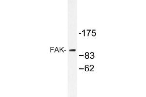 Image no. 1 for anti-PTK2 Protein tyrosine Kinase 2 (PTK2) antibody (ABIN272100) (FAK antibody)