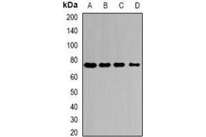 Western blot analysis of Citrin expression in HepG2 (A), Hela (B), mouse liver (C), mouse kidney (D) whole cell lysates.