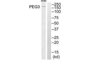 Western Blotting (WB) image for anti-Paternally Expressed 3 (PEG3) (Internal Region) antibody (ABIN1849956)