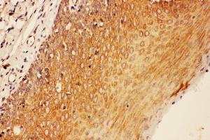 Anti-SOCS3 antibody, IHC(P) IHC(P): Human Tonsil Tissue (SOCS3 antibody  (Middle Region))