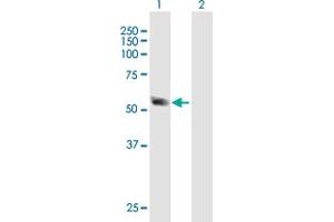 Western Blot analysis of SSB expression in transfected 293T cell line by SSB MaxPab polyclonal antibody. (SSB antibody  (AA 1-408))