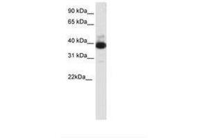 Image no. 1 for anti-Tetratricopeptide Repeat Domain 19 (TTC19) (C-Term) antibody (ABIN202316)