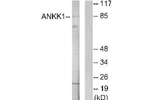 Western blot analysis of extracts from HeLa cells, using ANKK1 antibody. (ANKK1 antibody)