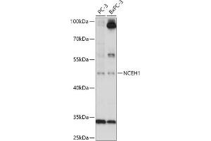 Western blot analysis of extracts of various cell lines, using NCEH1 antibody (ABIN7268897) at 1:1000 dilution. (NCEH1 antibody  (AA 90-440))