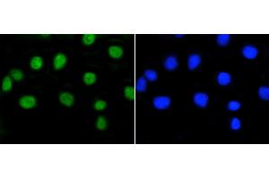 A549 cells were stained with Rb(S807) (2D10) Monoclonal Antibody  at [1:200] incubated for overnight at 4C, followed by secondary antibody incubation and DAPI staining. (Retinoblastoma 1 antibody  (pSer807))
