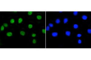 A549 cells were stained with Rb(S807) (2D10) Monoclonal Antibody  at [1:200] incubated for overnight at 4C, followed by secondary antibody incubation and DAPI staining. (Retinoblastoma 1 antibody  (pSer807))
