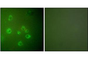 Immunofluorescence analysis of COS7 cells, using GRP78 antibody. (GRP78 antibody)