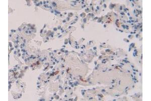 Immunohistochemistry (IHC) image for anti-Matrix Metallopeptidase 8 (Neutrophil Collagenase) (MMP8) (AA 101-467) antibody (ABIN1078309)