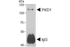 HEK293 lysate overexpressing Human DYKDDDDK-tagged PKD1 was used to immunoprecipitate PKD1 with 2ug ABIN4902745. (PKC mu antibody)