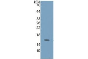 WB of Protein Standard: different control antibodies against Highly purified E. (HEXB ELISA Kit)