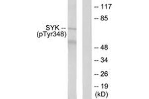 Western blot analysis of extracts from COS7 cells treated with EGF 200ng/ml 30', using SYK (Phospho-Tyr348) Antibody. (SYK antibody  (pTyr348))