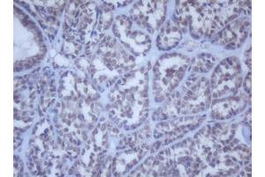 Image no. 15 for anti-DEAD (Asp-Glu-Ala-Asp) Box Polypeptide 59 (DDX59) (AA 1-303) antibody (ABIN1490728)