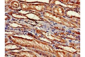 Immunohistochemistry of paraffin-embedded human kidney tissue using ABIN7142512 at dilution of 1:100 (RPS2 antibody  (AA 2-61))