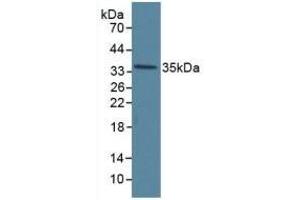 Detection of ANXA5 in Human Hela Cells using Polyclonal Antibody to Annexin V (ANXA5) (Annexin V antibody  (AA 1-320))