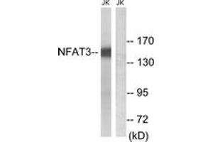 Western blot analysis of extracts from Jurkat cells, using NFAT3 (Ab-168/170) Antibody. (NFATC4 antibody  (AA 136-185))