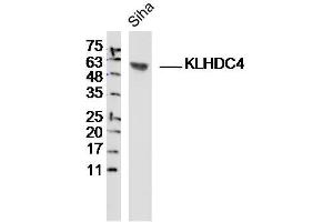 Siha lysates probed with KLHDC4 Polyclonal Antibody, Unconjugated  at 1:300 dilution and 4˚C overnight incubation. (KLHDC4 antibody  (AA 201-300))