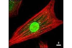 Immunofluorescence Microscopy: Rabbit anti-AKT antibody was used at a 1/80 dilution to stain cultured neonatal Rat cardiomyocytes that express a nuclear-targeted AKT construct. (AKT1 antibody  (C-Term))