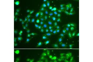 Immunofluorescence analysis of A549 cells using UCHL5 Polyclonal Antibody (UCHL5 antibody)
