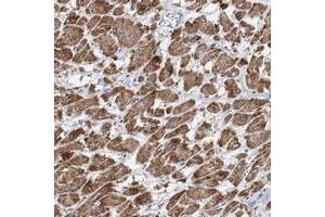 Immunohistochemical staining of human heart muscle with PPP2R3A polyclonal antibody  shows distinct cytoplasmic positivity in myocytes at 1:50-1:200 dilution.